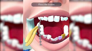 Perfect Smile Game New Max Levels Games Top Free Video Update VEALPFN