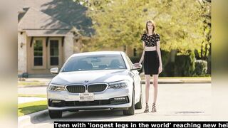 Teen with ‘longest legs in the world’ reaching new heights — on OnlyFans, World News Today, Stand Up