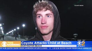 Girl attacked by coyote near Huntington Beach Pier