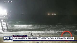 New video shows moment coyote attacks toddler on Huntington Beach