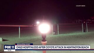 New video shows moment coyote attacks toddler on Huntington Beach