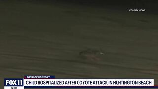 New video shows moment coyote attacks toddler on Huntington Beach