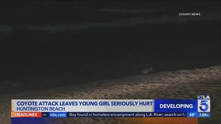 Coyote attacks 2-year-old near Huntington Beach Pier
