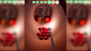 Earwax Clinic Game Max New Level Mobile Gaming Video Games OLJK183PLW