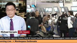 Canadian health officials issue travel notice over monkeypox