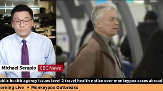 Canadian health officials issue travel notice over monkeypox