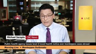 Canadian health officials issue travel notice over monkeypox