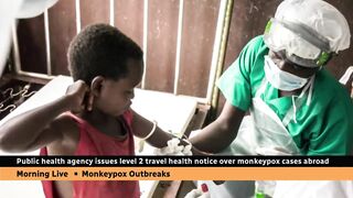 Canadian health officials issue travel notice over monkeypox