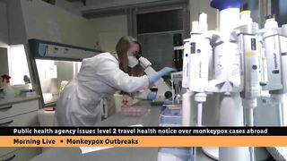 Canadian health officials issue travel notice over monkeypox