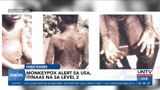 US CDC, itinaas ang monkeypox travel alert sa level 2; paggamit ng masks sa biyahe, inirekomenda