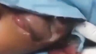 Best Biggest Pimple Popping And Cysts Compilation And Hacks