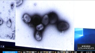 Health officials hold press conference in Long Beach to address rising Monkeypox cases