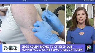 Biden Administration Moves To Stretch Out Monkeypox Vaccine Supply Amid Criticism