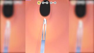 EarWax Clinic Games All Levels Gameplay Android,iOS New Level 183