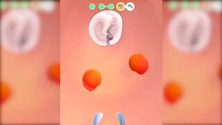 EarWax Clinic Games All Levels Gameplay Android,iOS New Level 183