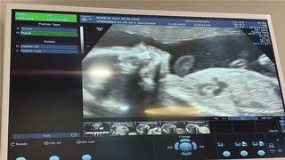 BABY STICKING TONGUE OUT ON ULTRASOUND//SMILING AND STRETCHING//OUR BABY BOY SPENCER AT 23 WEEKS//