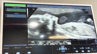 BABY STICKING TONGUE OUT ON ULTRASOUND//SMILING AND STRETCHING//OUR BABY BOY SPENCER AT 23 WEEKS//