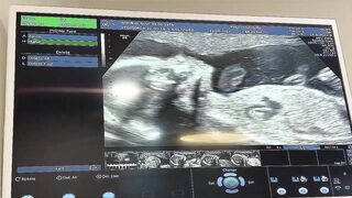 BABY STICKING TONGUE OUT ON ULTRASOUND//SMILING AND STRETCHING//OUR BABY BOY SPENCER AT 23 WEEKS//