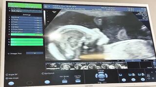 BABY STICKING TONGUE OUT ON ULTRASOUND//SMILING AND STRETCHING//OUR BABY BOY SPENCER AT 23 WEEKS//