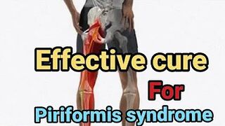 stretches for Piriformis syndrome (lower back pain) #pain #yttrending #piriformissyndrome