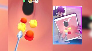 Earwax Clinic Games MAX LEVELS! Gameplay Walkthrough Update SXBCUO