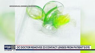 Newport Beach doctor removes '23 contact lenses' from patient's eye