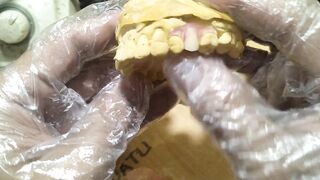 Pustiso Flexible Dentures.