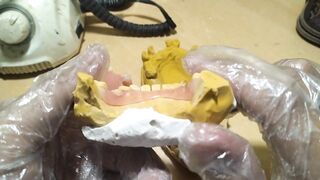 Pustiso Flexible Dentures.