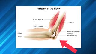 Flexible Joints: Tell me more!