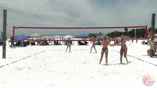 Amazing Beach Volleyball Players: Alexa Downie/Ali Denney vs. Sarah Hall/ Hayden Woodridge | Pt One