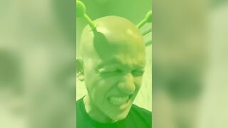 I prove I can’t grow PUEBES #comedy #funny #relatable #alopecia #shrek #puebes