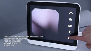 Single-use Digital Flexible Hysteroscope