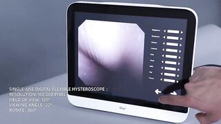 Single-use Digital Flexible Hysteroscope