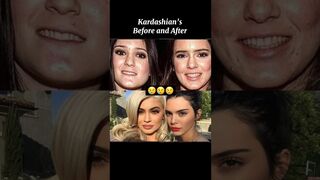 Kaardashian’s, before and after #shorts #celebrity