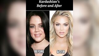 Kaardashian’s, before and after #shorts #celebrity