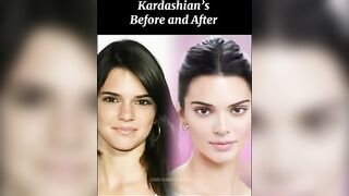 Kaardashian’s, before and after #shorts #celebrity