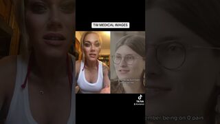 THIS IS TRAGIC!!! #viral #trending #facts #tiktok #news #medical #story #trans #viralvideo #reaction