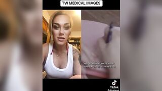 THIS IS TRAGIC!!! #viral #trending #facts #tiktok #news #medical #story #trans #viralvideo #reaction