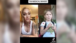 THIS IS TRAGIC!!! #viral #trending #facts #tiktok #news #medical #story #trans #viralvideo #reaction