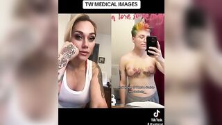 THIS IS TRAGIC!!! #viral #trending #facts #tiktok #news #medical #story #trans #viralvideo #reaction