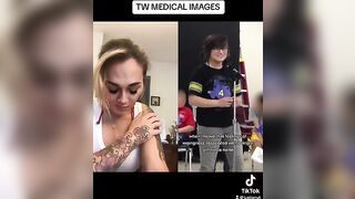 THIS IS TRAGIC!!! #viral #trending #facts #tiktok #news #medical #story #trans #viralvideo #reaction