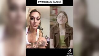 THIS IS TRAGIC!!! #viral #trending #facts #tiktok #news #medical #story #trans #viralvideo #reaction