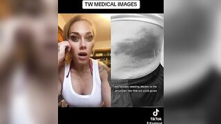 THIS IS TRAGIC!!! #viral #trending #facts #tiktok #news #medical #story #trans #viralvideo #reaction