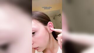 Can I get a cochlear implant to hear? ???? (Tiktok): Lizzytharris