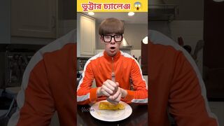 ????ছেলেটা ভুট্টার দানা এবং ইনজেকশনের challenge নেয় ???? videocredit:- Vector #shorts