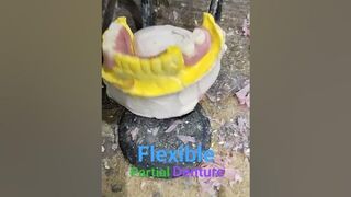 Flexible Removable Partial Denture set-up By Haider #dentalartbyhaider #flexibledentures #dentist