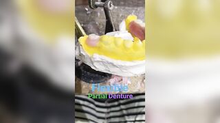 Flexible Removable Partial Denture set-up By Haider #dentalartbyhaider #flexibledentures #dentist