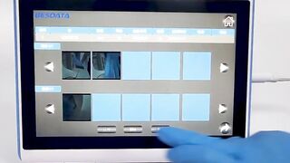 Mastering Flexible Bronchoscopy with BESDATA: Operation Demo on 10-Inch Medical Image Processor