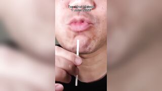 Doctor Tristan Peh Top Viral ASMR Videos Compilation ❤️