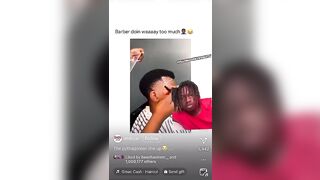 HE DID THIS TO HIS HAIRLINE! #tiktok #viral #share